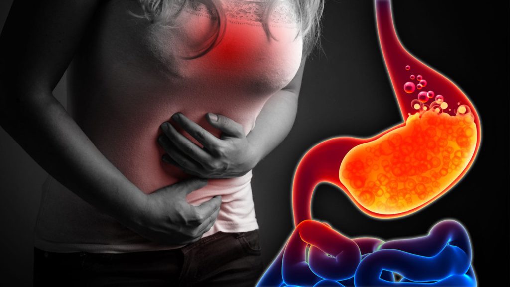 Why You Shouldn t Ignore GERD What Causes Gerd